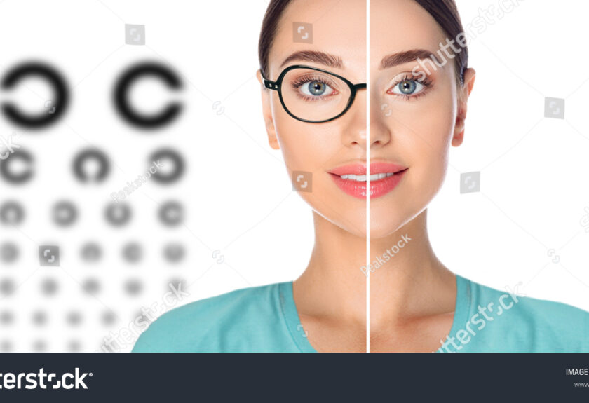 femme avant/après l'opération des yeux